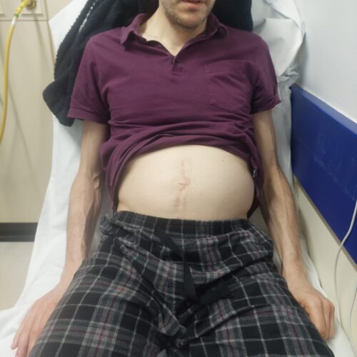 The biggest challenges in life aren’t likely to be freely chosen and physical